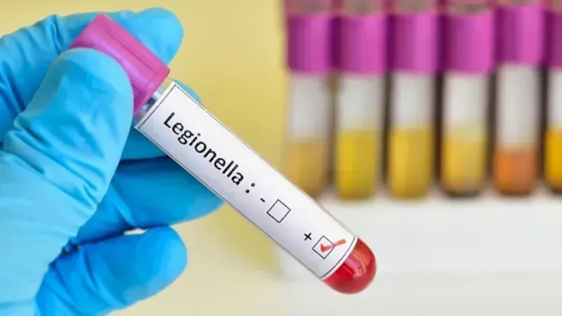 Legionella Training from GETOB and Muğla Provincial Health Directorate